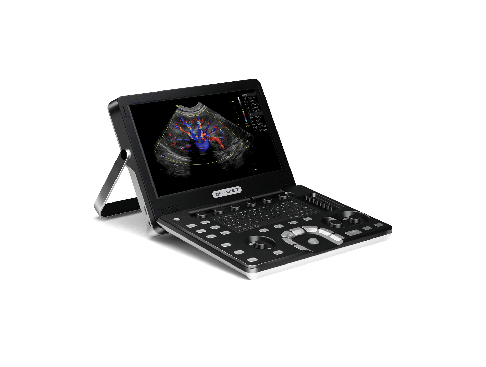 Echographe Vinno D2VET Portable en Couleur
