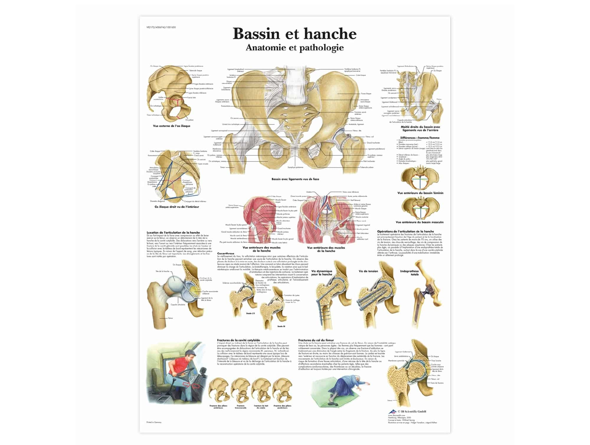 Planche anatomique Bassin et hanche - Anatomie et pathologie